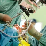 دستگاه تخصصی جراحی پارکینسون به اصفهان می آید